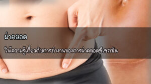 ผ่าคลอด